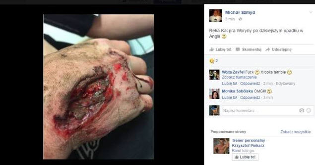 Травма руки Каспера Воруны. Диагноз после возвращения в Польшу